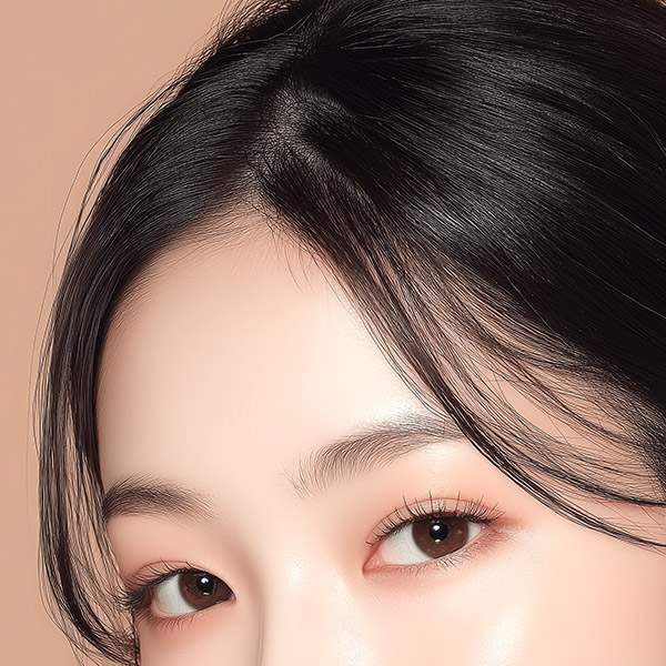 이마 보톡스