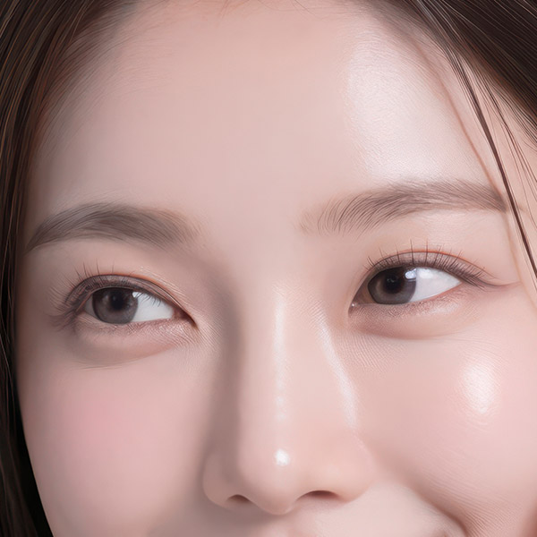 미간 보톡스