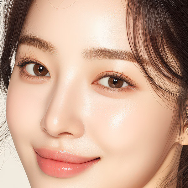 눈가 보톡스