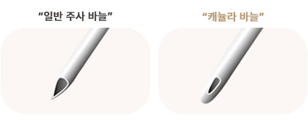 둥근 캐뉼라와 일반 주사바늘 비교